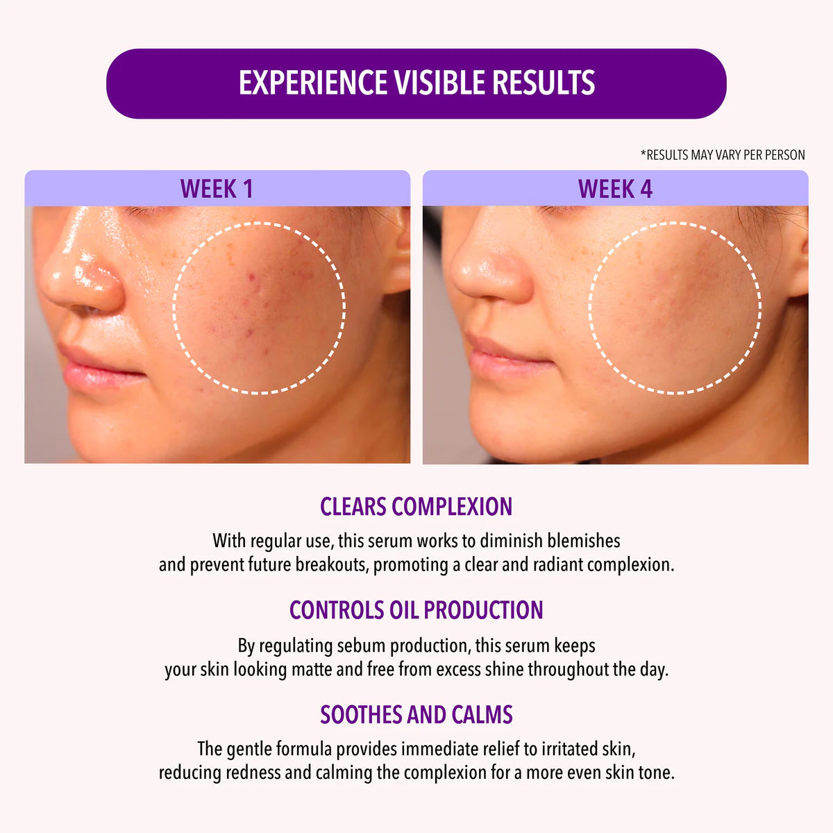 SERUM OIL CONTROL - MOIRA BEUTY