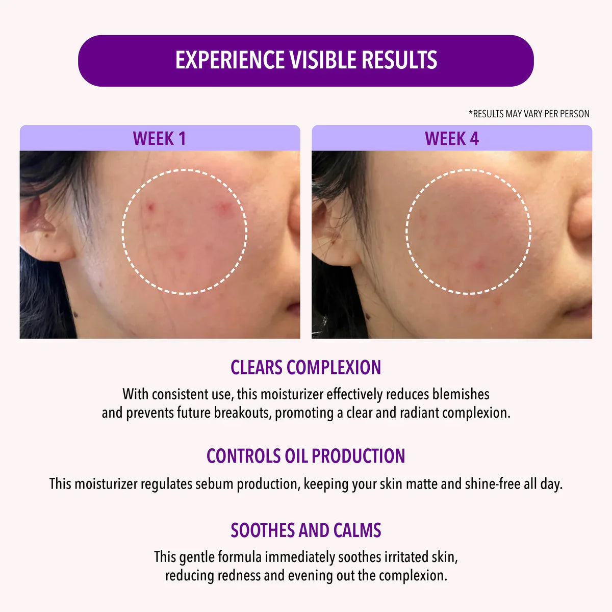 MOIRA BEAUTY OIL CONTROL MOISTURIZER FACIAL CREAM