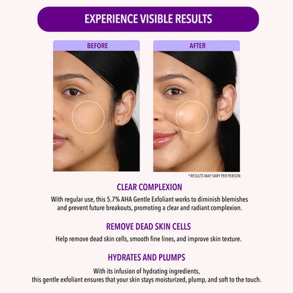 5.7 % Aha Gentle Exfoliant - Moira Cosmetics